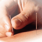 acupunctura :)